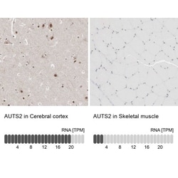 AUTS2 Antibody, Novus Biologicals 25ul | Buy Online | Novus Biologicals | Fisher Scientific